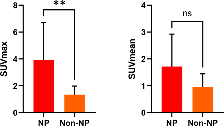 TSPO PET/MR in neuropsychiatric lupus: neuroinflammatory metabolic signatures and diagnostic biomarkers.