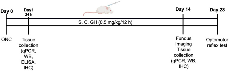Growth hormone reduces retinal inflammation and preserves microglial morphology after optic nerve crush in male rats.