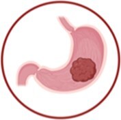 Circulating Tumor DNA detection in cancer: a comprehensive overview of current detection methods and prospects.