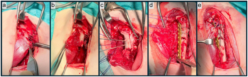 Complete vastus release to repair complex proximal femoral fractures: description and follow-up in four cats.