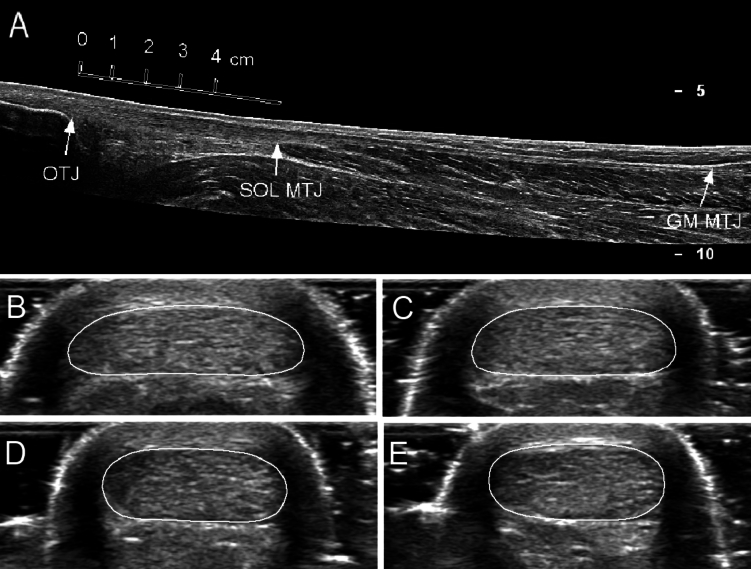 Gastrocnemius medialis tendon properties do not differ between male academy soccer players and control participants but are related to jump performance.