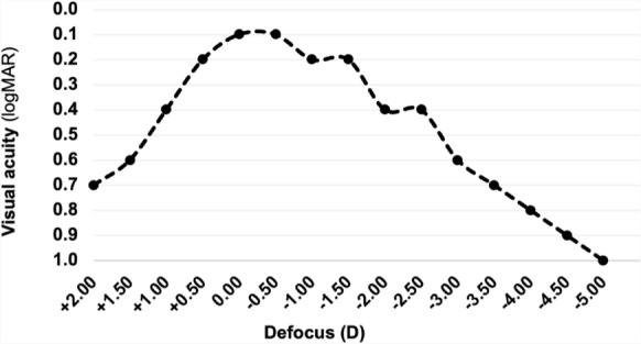 Bilateral implantation of a non-diffractive extended depth of focus intraocular lens in a pediatric patient with lamellar cataract.