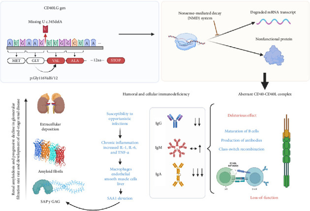 Acquired Renal Amyloidosis in a Patient With X-Linked Hyper-IgM Immunodeficiency With Novel Hemizygotic Pathogenic Variant in CD40LG Gene.