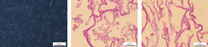 Fabrication of 3D Collagen-Based Decellularized Biological Scaffolds Using Human Wharton's Jelly-Derived Mesenchymal Stem Cells With Differentiation Potential Toward Chondrocytes.
