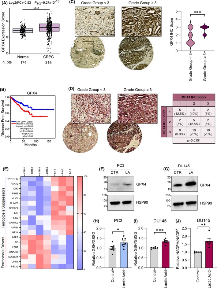 Targeting carbonic anhydrase IX/XII prevents the anti-ferroptotic effect of stromal lactic acid in prostate carcinoma.