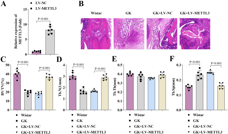 METTL3-Mediated m<sup>6</sup>A Regulation of GDF11 Promotes Socket Healing in Diabetic Rats.