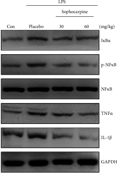 Erratum to "Sophocarpine Attenuates LPS-Induced Liver Injury and Improves Survival of Mice through Suppressing Oxidative Stress, Inflammation, and Apoptosis".