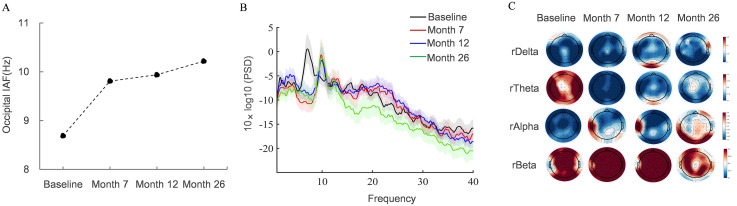 Integrating repetitive transcranial magnetic stimulation and Mediterranean diet for cognitive and anxiety improvement in early Alzheimer's disease: A case report and literature review.