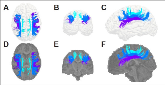 White Matter Integrity of the Three Subdivisions of the Superior Longitudinal Fasciculi in First-Episode Psychosis Patients.