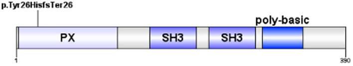 Osteomyelitis with a Pathologic Fracture, Mortal Liver Abscess, and Cholelithiasis: Distinct Features in two Families with the Same p47-phox Mutation.