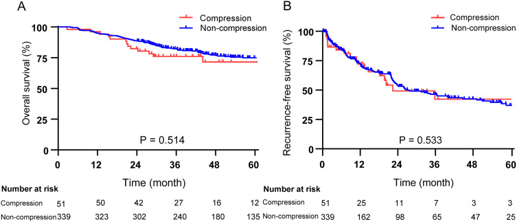 Tumor Compression of the Hepatic or Portal Vein Predicts the Presence of Microvascular Invasion and Satellite Nodules in Hepatocellular Carcinoma: A Retrospective Study.