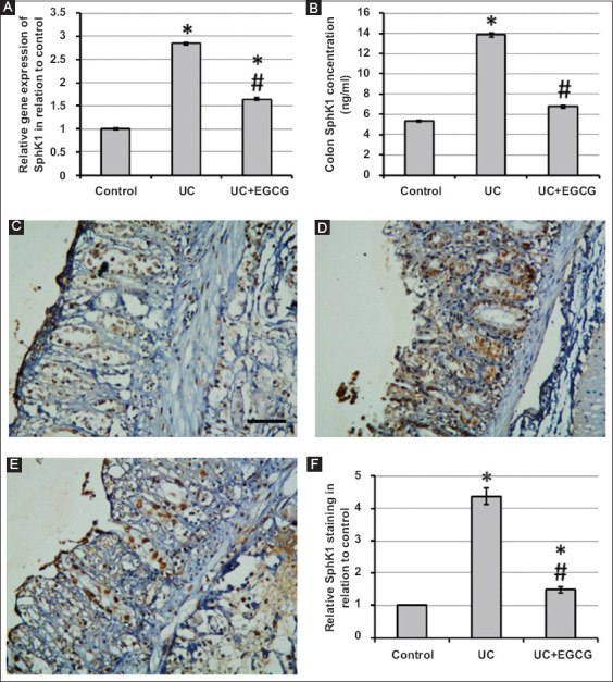 The therapeutic benefits of epigallocatechin gallate in rats with experimentally induced ulcerative colitis are achieved by influencing inflammation and apoptosis.