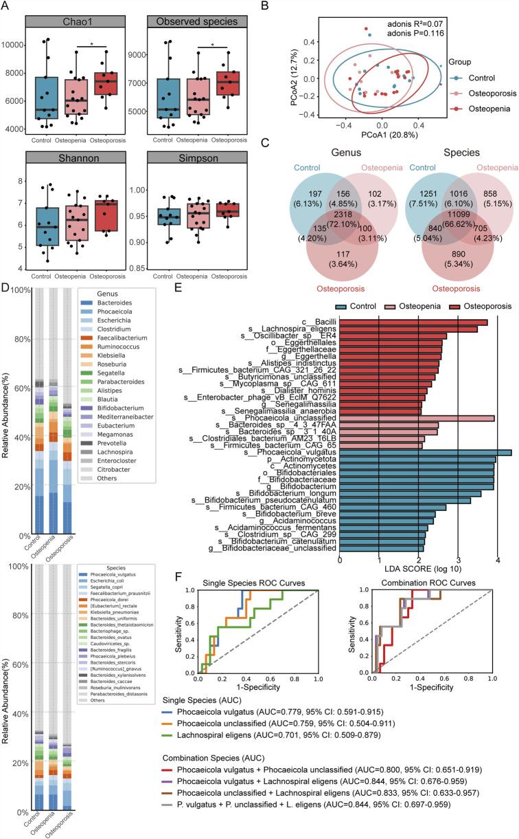 Gut microbiota-metabolome remodeling associated with low bone mass: an integrated multi-omics study in fracture patients.