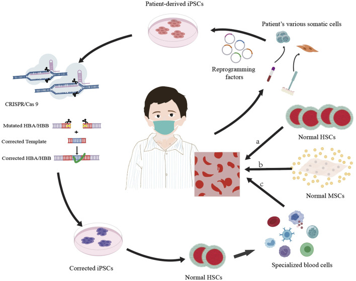CRISPR/Cas-edited iPSCs and mesenchymal stem cells: a concise review of their potential in thalassemia therapy.