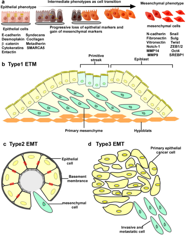 The impact of miRNAs on epithelial-mesenchymal transition in lung cancer and the latest advances in their use as diagnostic markers.
