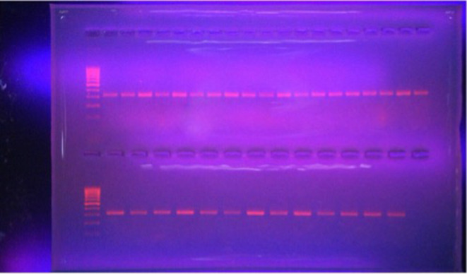 Association of WEE2 Gene Polymorphism with Fertilization Failure in Women Undergoing Intracytoplasmic Sperm Injection.