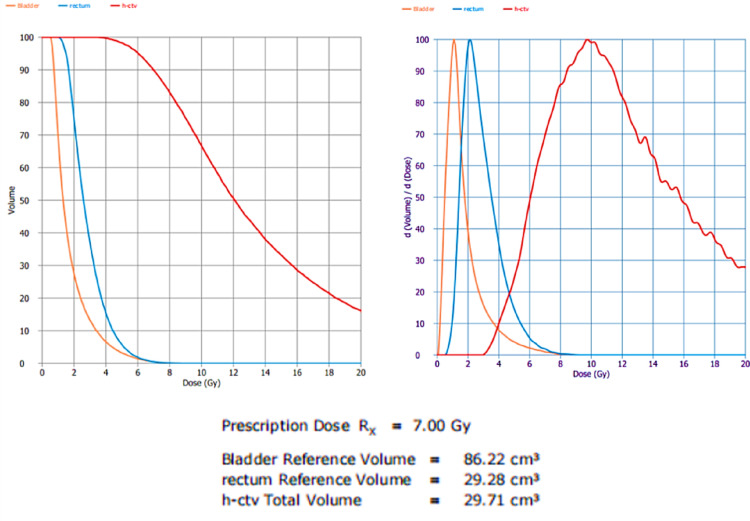 Dosimetry evaluation and uncertainty analysis of Cobalt-60 HDR brachytherapy for cervical cancer in resource-limited settings.
