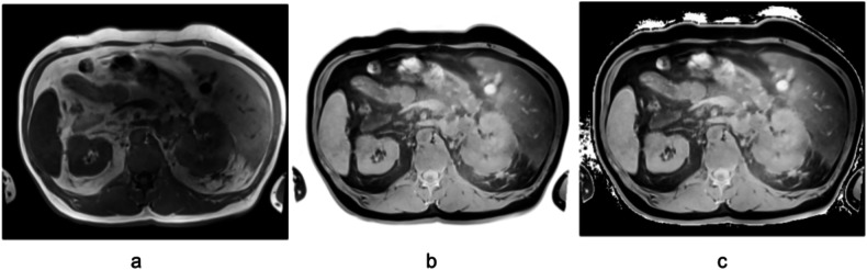 MRI annotation using an inversion-based preprocessing for CT model adaptation.