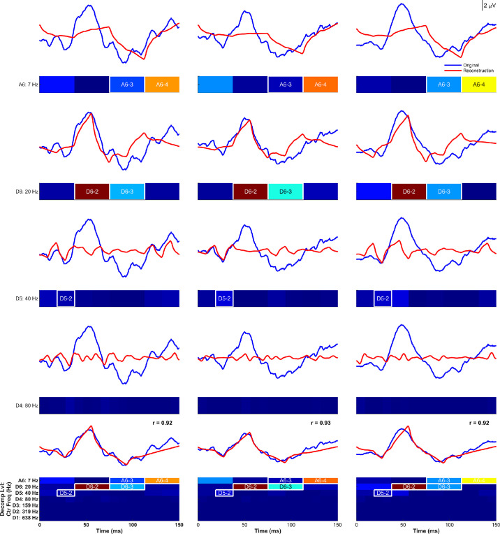 Multidimensional Quantification of Macular Cone Activity in Pattern Electroretinography Using Discrete Wavelet Transform.
