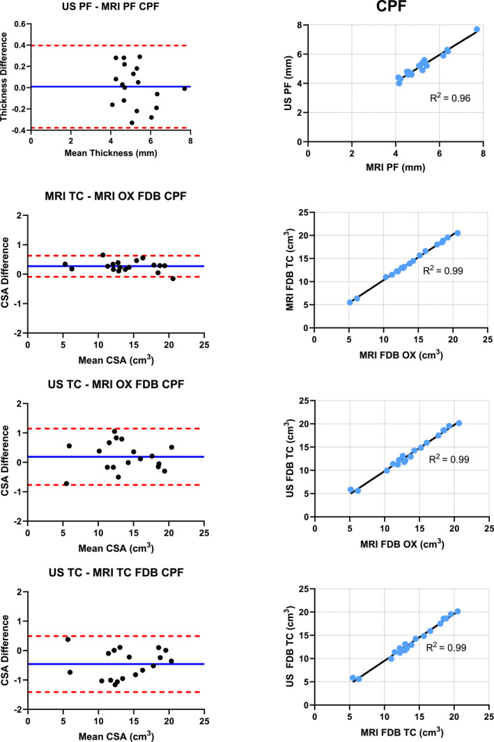 Validity of MRI and Ultrasound Volume Measurements of Foot Muscles and Plantar Fascia Cross-Sectional Area Within Older Adults With and Without Chronic Plantar Fasciitis.