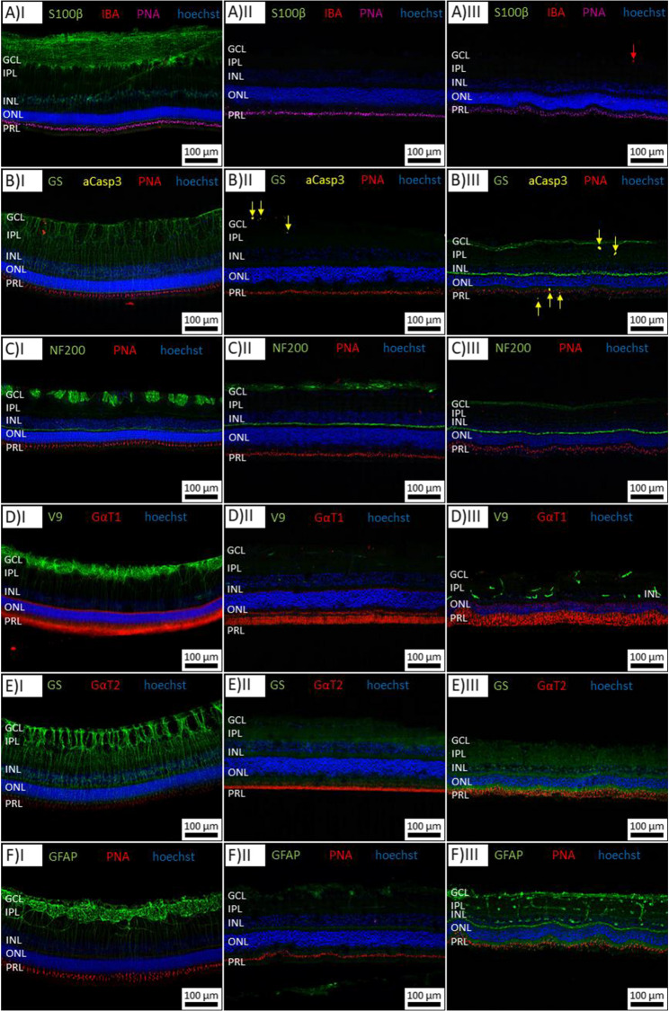 Organotypic Culture of Adult Vascularized Porcine Retina Explants In Vitro on Nanotube Scaffolds.