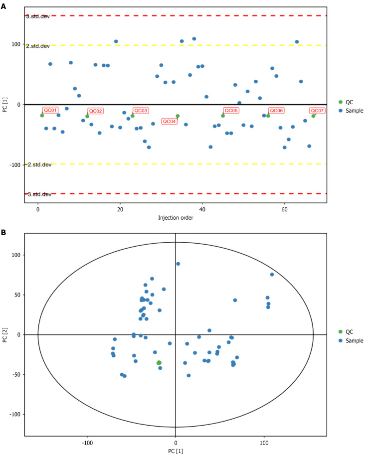 Untargeted metabolomics analysis of metabolite changes in gastric cancer patients from plateau regions.