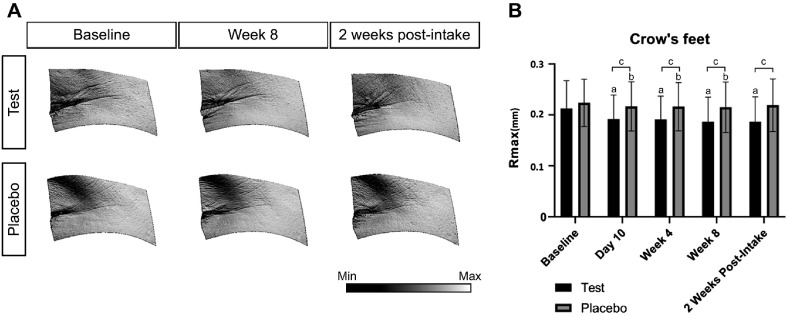 Skin Anti-Aging and Moisturizing Effects of Low-Molecular-Weight Collagen Peptide Supplementation in Healthy Adults: A Randomized, Double-Blind, Placebo-Controlled Clinical Trial.