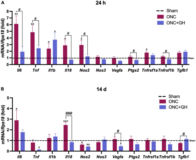 Growth hormone reduces retinal inflammation and preserves microglial morphology after optic nerve crush in male rats.