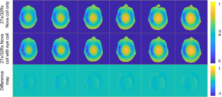 Low-Cost and Detunable Wireless Resonator Glasses for Enhanced Eye MRI with Concurrent High-Quality Whole-Brain MRI.