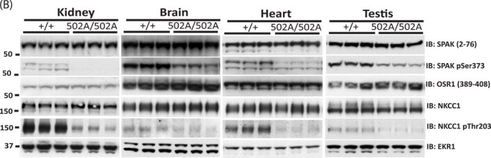 Correction to: Critical role of the SPAK protein kinase CCT domain in controlling blood pressure.