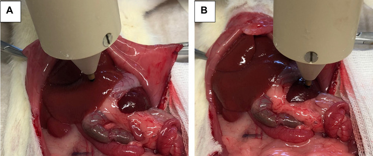 Pharmacological Modulation of Liver and Spleen Stiffness in a Cirrhotic Rat Model.