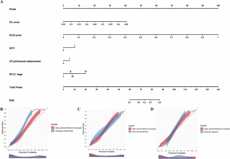 Augmenting conventional criteria: a CT-based deep learning radiomics nomogram for early recurrence risk stratification in hepatocellular carcinoma after liver transplantation.