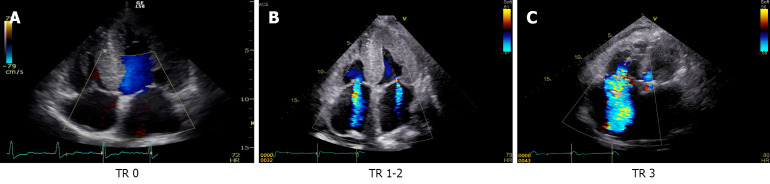 Image analysis of cardiac hepatopathy secondary to heart failure: Machine learning <i>vs</i> gastroenterologists and radiologists.