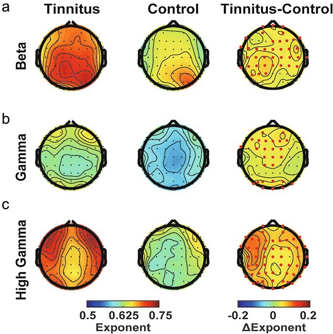 Abnormally enhanced temporal correlations of alpha oscillations across multiple timescales in tinnitus patients.