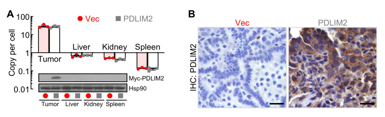 NanoPDLIM2-Based Combination Therapy for Lung Cancer Treatment in Mouse Preclinical Studies.