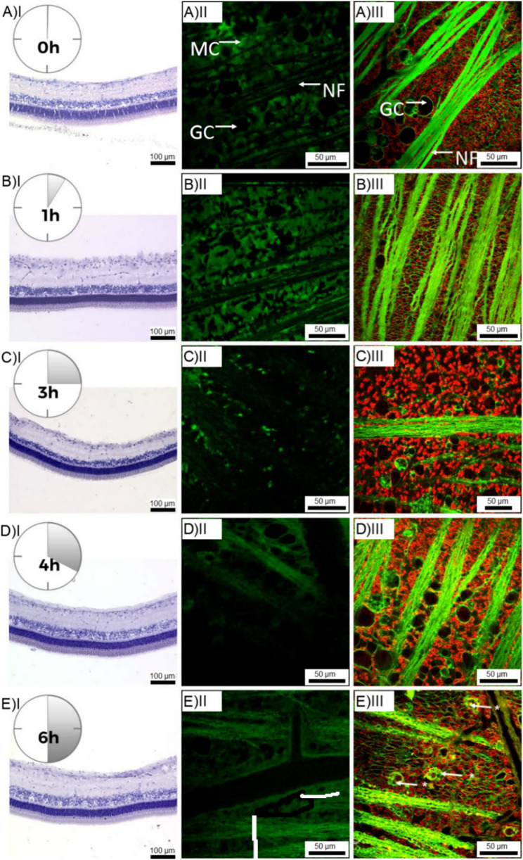 Organotypic Culture of Adult Vascularized Porcine Retina Explants In Vitro on Nanotube Scaffolds.