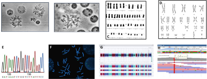 International Society for Prenatal Diagnosis 2024 Debate 3-Cytogenetics Is a Dinosaur and Should Be Replaced by Molecular Technologies.