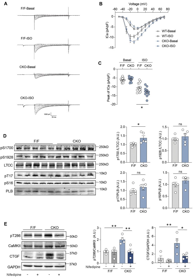 Cardiac β2 adrenergic receptor deletion drives calmodulin kinase II upregulation to induce connective tissue growth factor in cardiac fibrosis and diastolic dysfunction.