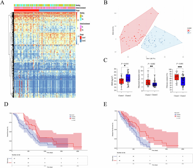 CT-based radiomics models decode fibrosis content and molecular differences in pancreatic ductal adenocarcinoma: a multi-institutional study.