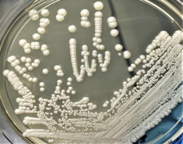 Central line-associated <i>Cyberlindnera fabianii</i> fungemia: A case report and review of diagnostic and therapeutic challenges.