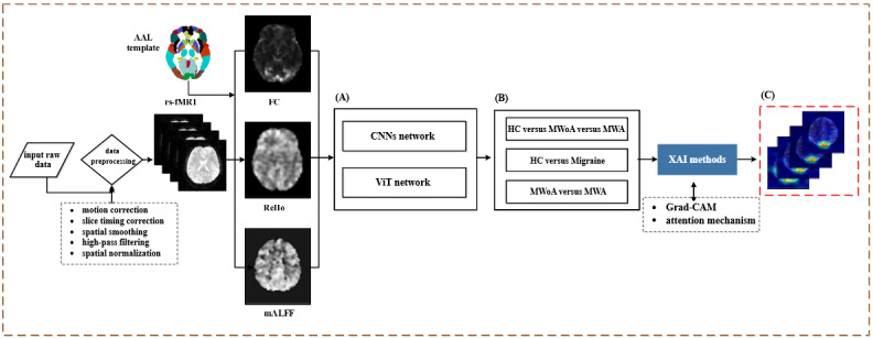 Interpretable Artificial Intelligence Analysis of Functional Magnetic Resonance Imaging for Migraine Classification: Quantitative Study.
