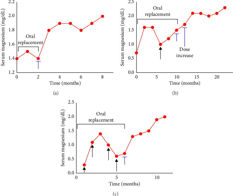 SGLT2 Inhibitors as a Therapeutic Option for Both Acute and Chronic Refractory Hypomagnesemia in Diabetic and Nondiabetic Patients: A Multicenter Case Series.