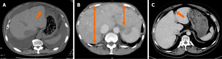 Image analysis of cardiac hepatopathy secondary to heart failure: Machine learning <i>vs</i> gastroenterologists and radiologists.