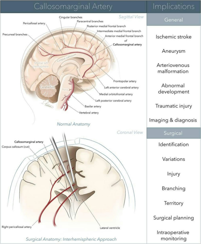 Callosomarginal artery: an in-depth of anatomical characteristics, clinical significance, neurosurgical considerations, and surgical applications.