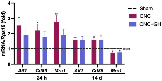 Growth hormone reduces retinal inflammation and preserves microglial morphology after optic nerve crush in male rats.