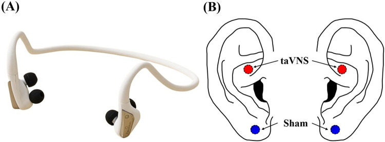 Effect of transcutaneous auricular vagus nerve stimulation on stress regulation: an EEG and questionnaire study.