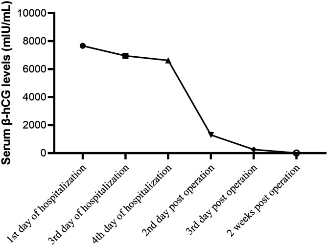 Retroperitoneal ectopic pregnancy localized to the mesorectum: A case report and mini-review of literature.