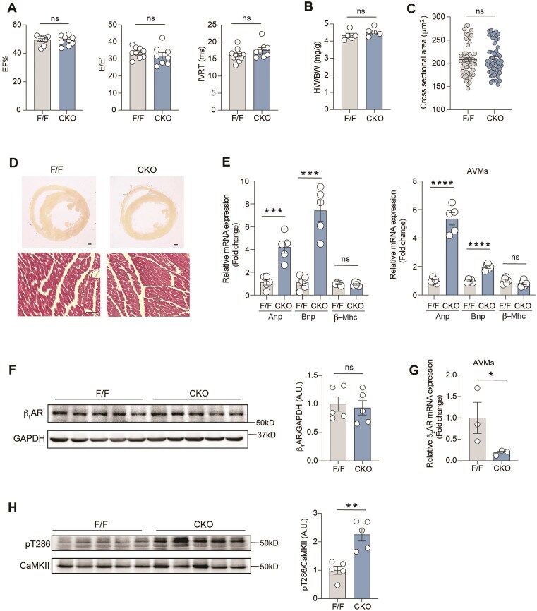 Cardiac β2 adrenergic receptor deletion drives calmodulin kinase II upregulation to induce connective tissue growth factor in cardiac fibrosis and diastolic dysfunction.
