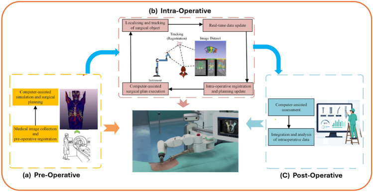 Revolutionizing spine surgery with emerging AI-FEA integration.