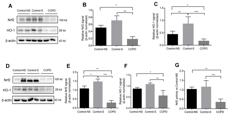 TET1 Alleviates Cigarette Smoke Induced Bronchial Epithelial Cell Apoptosis Through Upregulating Nrf2.